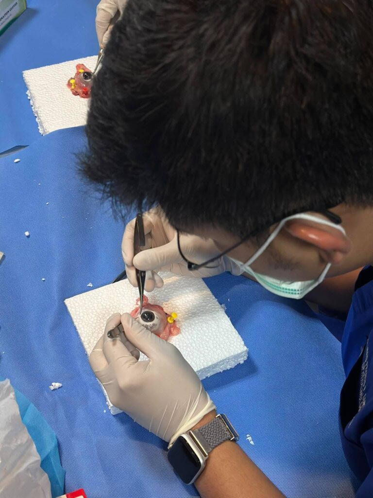 Close-up of a participant practicing cornea retrieval technique on a training specimen